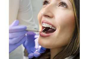 Medicina Dentária - Ortodôntia
