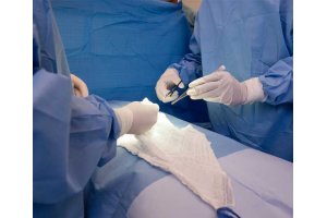 Cirurgia Bariatrica